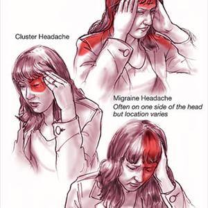Migraine Aura Treatment - Buy Fioricet And Get Migraine Relief  