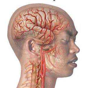 Ocular Vascular Migraine - Just Where You Should Look For Information On Migraine Headaches 