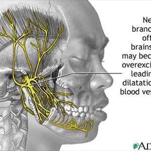 Ocular Migraine Triggers - Migraine Headaches - The Most Commonly Used Nutritional Supplements For Migraine Prevention